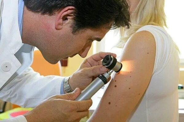 Diagnosis of papillomas